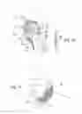 Fig. 20 - Systems and methods for moving and/or restraining tissue in the oral cavity