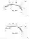 Fig. 26 - Systems and methods for moving and/or restraining tissue in the oral cavity