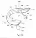 Fig. 28 - Systems and methods for moving and/or restraining tissue in the oral cavity