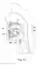 Fig. 29 - Systems and methods for moving and/or restraining tissue in the oral cavity