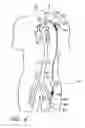 Fig. 07 - Implantable heart assist system and method of applying same