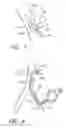 Fig. 08 - Implantable heart assist system and method of applying same