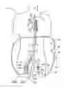 Fig. 10 - Implantable heart assist system and method of applying same