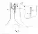 Fig. 14 - Implantable heart assist system and method of applying same