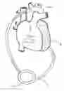 Fig. 01 - Implantable heart assist system and method of applying same
