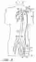 Fig. 04 - Implantable heart assist system and method of applying same