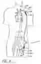 Fig. 07 - Implantable heart assist system and method of applying same