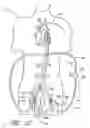 Fig. 10 - Implantable heart assist system and method of applying same