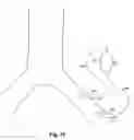 Fig. 11 - Implantable heart assist system and method of applying same