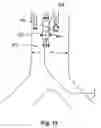 Fig. 13 - Implantable heart assist system and method of applying same