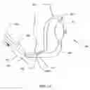 Fig. 15 - Implantable heart assist system and method of applying same