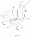 Fig. 16 - Implantable heart assist system and method of applying same