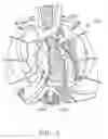 Fig. 04 - Method and device for deployment of a sub-pericardial sack