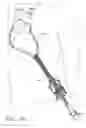 Fig. 08 - Method and device for deployment of a sub-pericardial sack