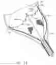 Fig. 19 - Method and device for deployment of a sub-pericardial sack