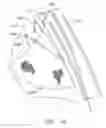 Fig. 20 - Method and device for deployment of a sub-pericardial sack