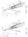 Fig. 22 - Method and device for deployment of a sub-pericardial sack