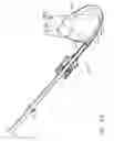 Fig. 30 - Method and device for deployment of a sub-pericardial sack