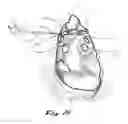 Fig. 03 - Apparatus and methods for performing ablation