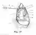 Fig. 04 - Apparatus and methods for performing ablation