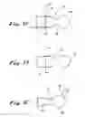 Fig. 10 - Apparatus and methods for performing ablation