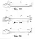 Fig. 16 - Apparatus and methods for performing ablation
