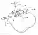 Fig. 01 - Surgical instruments and methods for use in reduced-access surgical sites