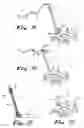Fig. 04 - Surgical instruments and methods for use in reduced-access surgical sites
