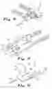 Fig. 10 - Surgical instruments and methods for use in reduced-access surgical sites