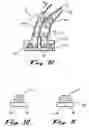 Fig. 08 - Surgical stabilizers and methods for use in reduced-access surgical sites