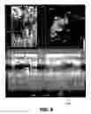 Fig. 07 - Medical imaging system and a method for segmenting an object of interest