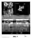 Fig. 08 - Medical imaging system and a method for segmenting an object of interest