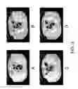 Fig. 04 - Method and system for guided two dimensional colon screening