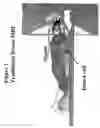 Fig. 02 - Magnetic resonance imaging device