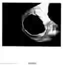 Fig. 07 - Magnetic resonance imaging device