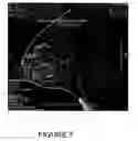 Fig. 09 - Magnetic resonance imaging device