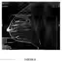 Fig. 10 - Magnetic resonance imaging device