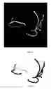 Fig. 05 - Simultaneous projection of multi-branched vessels and their context on a single image