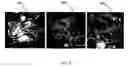 Fig. 08 - Simultaneous projection of multi-branched vessels and their context on a single image
