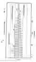Fig. 05 - Self-condensing pH sensor and catheter apparatus