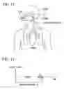 Fig. 15 - Device for measuring respiration during sleep