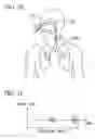 Fig. 16 - Device for measuring respiration during sleep