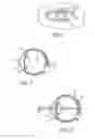 Fig. 02 - Method and apparatus for aligning a mask with the visual axis of an eye
