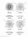 Fig. 06 - Method and apparatus for aligning a mask with the visual axis of an eye