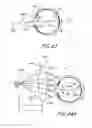 Fig. 09 - Method and apparatus for aligning a mask with the visual axis of an eye