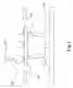 Fig. 04 - Massage apparatus