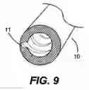 Fig. 10 - Treatment of blood with light