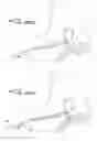 Fig. 22 - Dialysis catheter