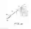 Fig. 25 - Dialysis catheter