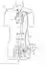 Fig. 01 - Cannulae having a redirecting tip